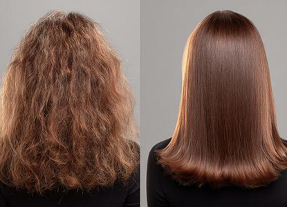 Hair Botox in Guwahati